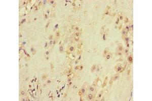 Immunohistochemistry of paraffin-embedded human placenta tissue using ABIN7175563 at dilution of 1:100 (VDAC2 anticorps  (AA 2-36))