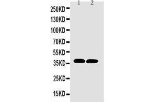 Anti-MTCO1 antibody,  Western blotting Lane 1: Rat Heart Tissue Lysate Lane 2: Mouse Heart Tissue Lysate