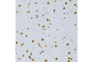 Immunohistochemistry of paraffin-embedded rat brain using SNRNP70 antibody.