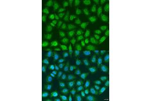 Immunofluorescence analysis of U2OS cells using SOCS4 antibody. (SOCS4 anticorps  (AA 1-270))