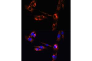 Immunofluorescence analysis of NIH/3T3 cells using A antibody (ABIN3022193, ABIN3022194, ABIN3022195 and ABIN6218659) at dilution of 1:100.