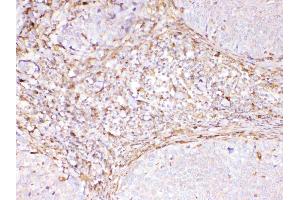 IHC analysis of Cyclophilin B using anti-Cyclophilin B antibody .