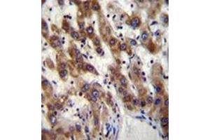 Immunohistochemistry analysis in formalin fixed and paraffin embedded human liver tissue reacted with PHF20 Antibody (N-term) followed which was peroxidase conjugated to the secondary antibody and followed by DAB staining. (PHF20 anticorps  (N-Term))