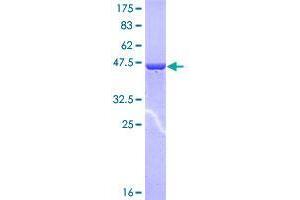 Image no. 1 for Copper Metabolism (Murr1) Domain Containing 1 (COMMD1) (AA 1-190) protein (GST tag) (ABIN1350007)