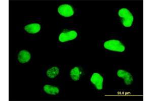 Immunofluorescence of monoclonal antibody to ZNF207 on HeLa cell. (ZNF207 anticorps  (AA 1-110))