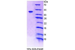 SDS-PAGE analysis of Human TNS1 Protein. (Tensin 1 Protein (TNS1))
