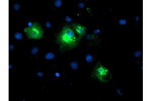 Image no. 2 for anti-Lysophosphatidic Acid Receptor 1 (LPAR1) antibody (ABIN1499191)