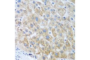 Immunohistochemistry of paraffin-embedded human liver using UBE2U antibody (ABIN6130858, ABIN6149825, ABIN6149826 and ABIN6224418) at dilution of 1:100 (40x lens). (UBE2U anticorps  (AA 1-226))