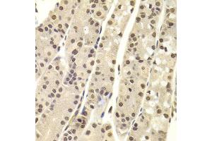 Immunohistochemistry of paraffin-embedded Human gastric using DNTT antibody at dilution of 1:100 (x400 lens). (TdT anticorps)