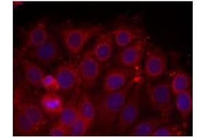 Image no. 2 for anti-VEGF Receptor 2 (VEGFR2) (Tyr1175) antibody (ABIN197237) (VEGFR2/CD309 anticorps  (Tyr1175))