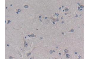 Detection of MEAI in Human Cerebrum Tissue using Polyclonal Antibody to Menin (MEAI) (Menin anticorps  (AA 219-395))
