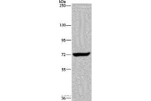 Western blot analysis of K562 cell, using ZC3H12A Polyclonal Antibody at dilution of 1:200 (ZC3H12A anticorps)