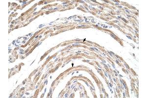 CPSF6 antibody was used for immunohistochemistry at a concentration of 16. (CPSF6 anticorps  (Middle Region))
