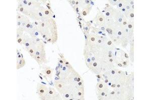 Immunohistochemistry of paraffin-embedded Human stomach using CHRAC1 Polyclonal Antibody at dilution of 1:100 (40x lens). (CHRAC1 anticorps)