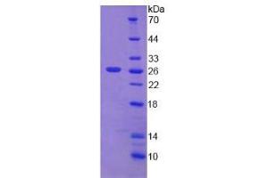Image no. 1 for Desmoplakin (DSP) (AA 2609-2822) protein (His tag) (ABIN6236843) (Desmoplakin Protein (DSP) (AA 2609-2822) (His tag))