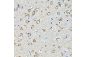 Immunohistochemistry of paraffin-embedded rat brain using TOLLIP antibody. (TOLLIP anticorps  (AA 1-274))