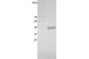 Western Blotting (WB) image for Plasminogen Activator Inhibitor 1 (SERPINE1) (AA 24-402) protein (His tag) (ABIN7124465)