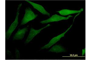 Immunofluorescence of monoclonal antibody to ACSS2 on HeLa cell.