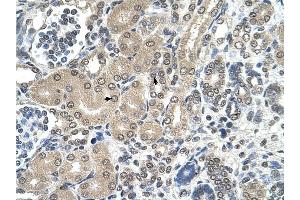 RRP1 antibody was used for immunohistochemistry at a concentration of 4-8 ug/ml to stain Epithelial cells of renal tubule (arrows) in Human Kidney. (RRP1 anticorps)