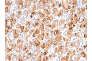 Formalin-fixed, paraffin-embedded human Thyroid stained with Thyroglobulin Mouse Recombinant Monoclonal Antibody (r2H11).