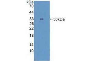 Detection of Recombinant TTK, Human using Polyclonal Antibody to TTK Protein Kinase (TTK)