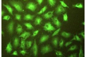 Detection of gGT1 in A549 cells using Polyclonal Antibody to Gamma-Glutamyltransferase 1 (gGT1)