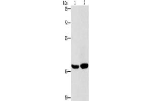 Gel: 8 % SDS-PAGE, Lysate: 40 μg, Lane 1-2: Human fetal brain tissue, 231 cells, Primary antibody: ABIN7128713(CAB39L Antibody) at dilution 1/400, Secondary antibody: Goat anti rabbit IgG at 1/8000 dilution, Exposure time: 15 seconds (CAB39L anticorps)