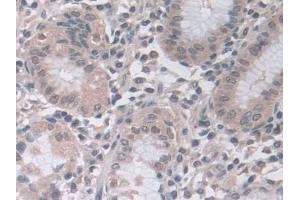 Detection of PSMa5 in Human Stomach Tissue using Polyclonal Antibody to Proteasome Subunit Alpha Type 5 (PSMa5)