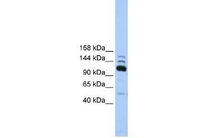 POLR3B antibody used at 1 ug/ml to detect target protein. (POLR3B anticorps  (C-Term))