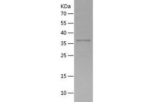 Western Blotting (WB) image for Golgi phosphoprotein 3 (Coat-Protein) (GOLPH3) (AA 1-298) protein (His tag) (ABIN7123182)