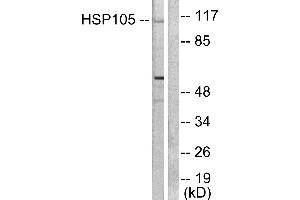 Western blot analysis of extracts from HeLa cells, using HSP105 antibody (#C0231). (HSPH1 anticorps)