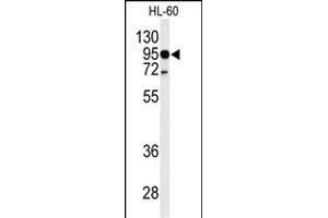 Western blot analysis of TLR4 Antibody (Center) (ABIN653638 and ABIN2842986) in HL-60 cell line lysates (35 μg/lane). (TLR4 anticorps  (AA 669-698))