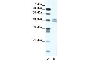 WB Suggested Anti-TRIAntibody Titration:  5. (TRIP13 anticorps  (N-Term))