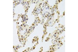 Immunohistochemistry of paraffin-embedded rat lung using HDGF Antibody. (HDGF anticorps  (AA 1-240))