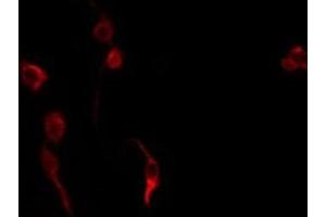 anti-Zinc Finger Protein 420 (ZNF420) (Internal Region) antibody