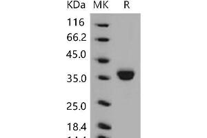 Western Blotting (WB) image for Epithelial Cell Adhesion Molecule (EPCAM) protein (His tag) (ABIN7320222)