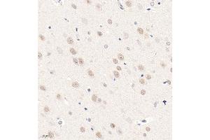 Immunohistochemistry analysis of paraffin embedded rat brain using ZNF771 (ABIN7076273) at dilution of 1: 600