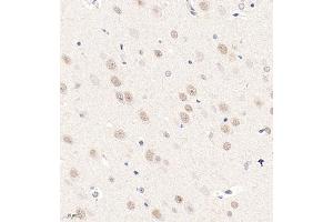 Immunohistochemistry analysis of paraffin embedded rat brain using ZNF771 (ABIN7076273) at dilution of 1: 600 (ZNF771 anticorps)