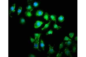 Immunofluorescence staining of A549 cells with ABIN7166328 at 1:133, counter-stained with DAPI. (WWC2 anticorps  (AA 828-1127))