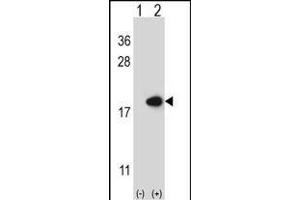 Western blot analysis of FABP2 (arrow) using rabbit polyclonal FABP2 Antibody (N-term) (ABIN656830 and ABIN2846039). (FABP2 anticorps  (N-Term))