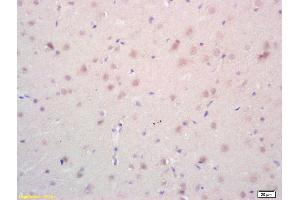Formalin-fixed and paraffin embedded rat brain labeled with Rabbit Anti phospho-Androgen Receptor(Ser578) Polyclonal Antibody, Unconjugated (ABIN730123) at 1:200 followed by conjugation to the secondary antibody and DAB staining (Androgen Receptor anticorps  (pSer578))