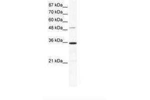 Image no. 1 for anti-Zinc Finger Protein 610 (ZNF610) (AA 70-119) antibody (ABIN6736026) (ZNF610 anticorps  (AA 70-119))