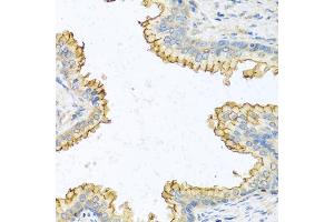 Immunohistochemistry of paraffin-embedded human prostate using RN antibody  at dilution of 1:100 (40x lens).