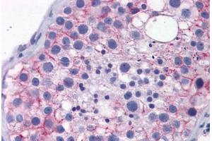 Human Testis: Formalin-Fixed, Paraffin-Embedded (FFPE)