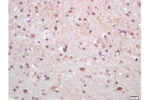 Formalin-fixed and paraffin embedded rat brain labeled with Anti Prostatic Acid Phosphatase Polyclonal Antibody (ABIN716996), Unconjugated at 1:200, followed by conjugation to the secondary antibody and DAB staining (ACPP anticorps  (AA 21-120))