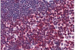 Human Thymus: Formalin-Fixed, Paraffin-Embedded (FFPE)