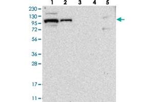 Western blot analysis of Lane 1: RT-4, Lane 2: U-251 MG, Lane 3: Human Plasma, Lane 4: Liver, Lane 5: Tonsil with BICD2 polyclonal antibody . (BICD2 anticorps)