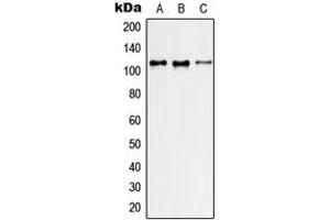 Western blot analysis of GEF H1 expression in HeLa (A), NIH3T3 (B), H9C2 (C) whole cell lysates. (ARHGEF2 anticorps  (Center))
