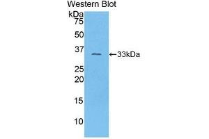 Detection of Recombinant COL1a1, Mouse using Polyclonal Antibody to Collagen Type I Alpha 1 (COL1a1)