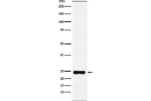 Western blot analysis of BAG2 expression in HeLa cell lysate.